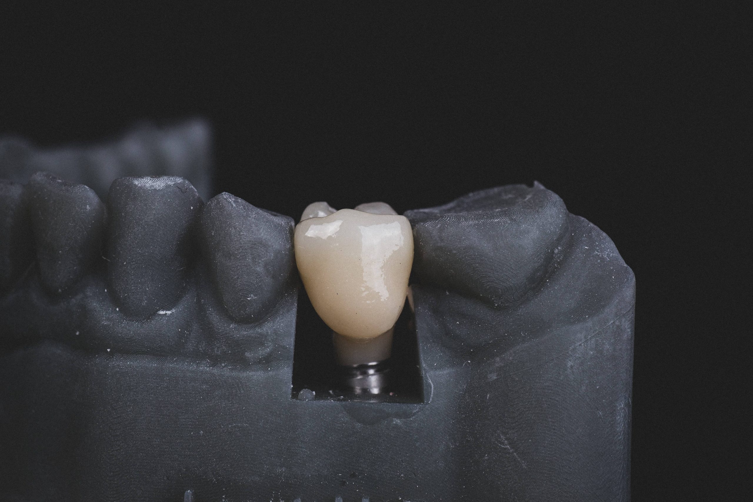 Enterprise Same-Day Dental Crowns (CEREC)